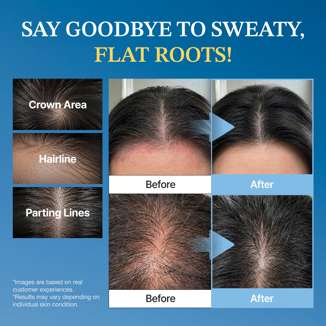 ELOP Mega Vita Anti-Hair Loss Scalp Essence