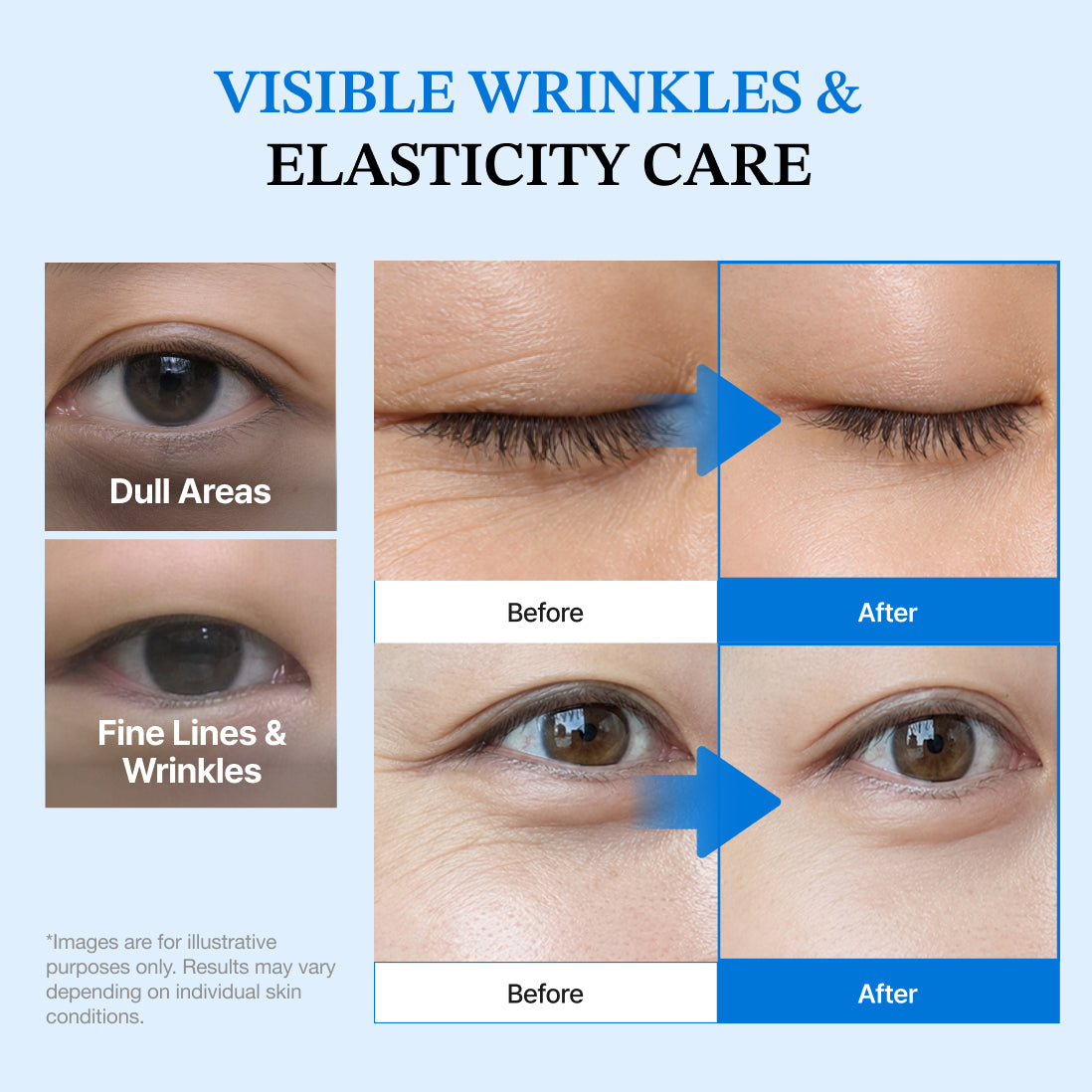 Dermizen AG eye lift pro