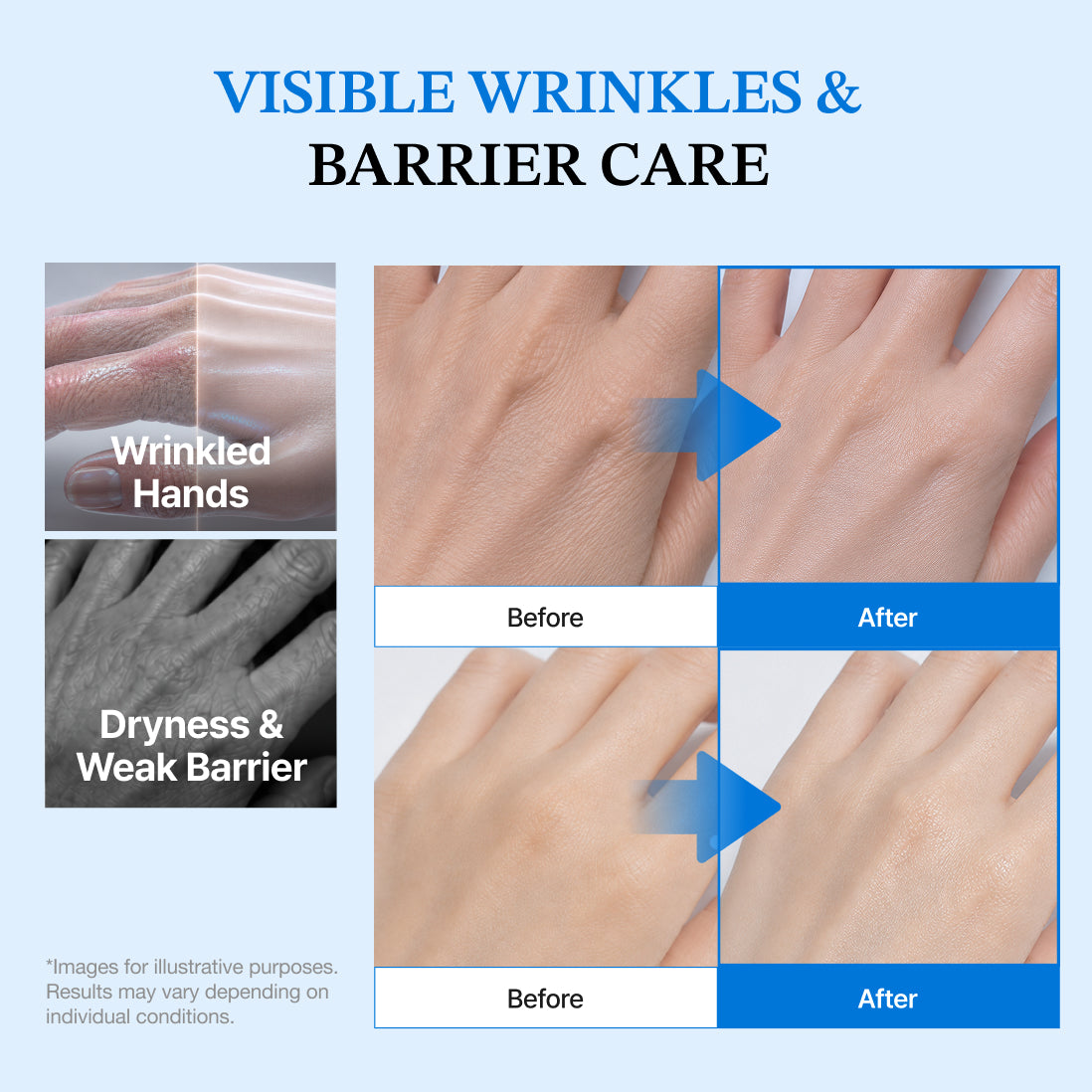 Dermizen Ag NMN Hand Ampoule