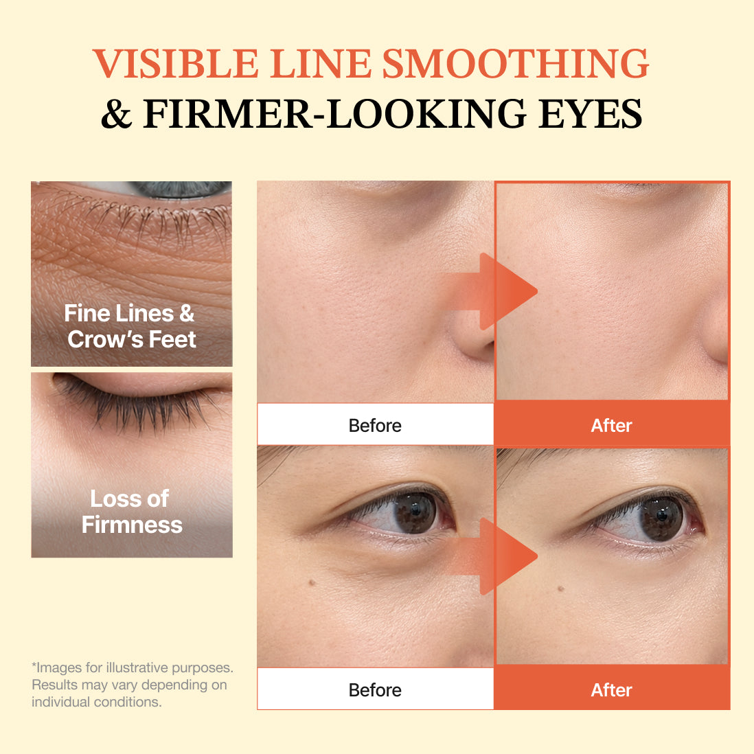 Dermizen Ag PDRN Eye Ampoule