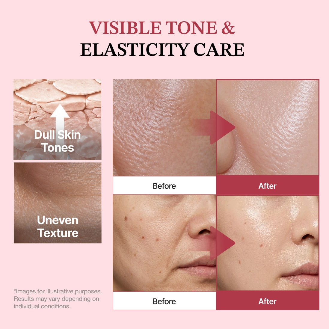 Dermizen AG Collagen Boosting Gel