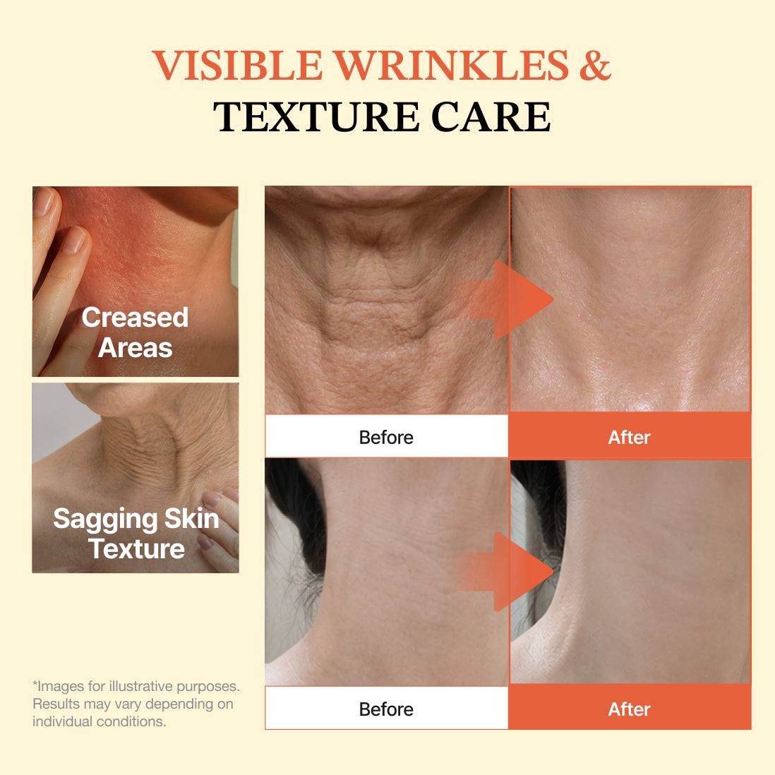 Dermizen Ag PDRN Neck Line Cream