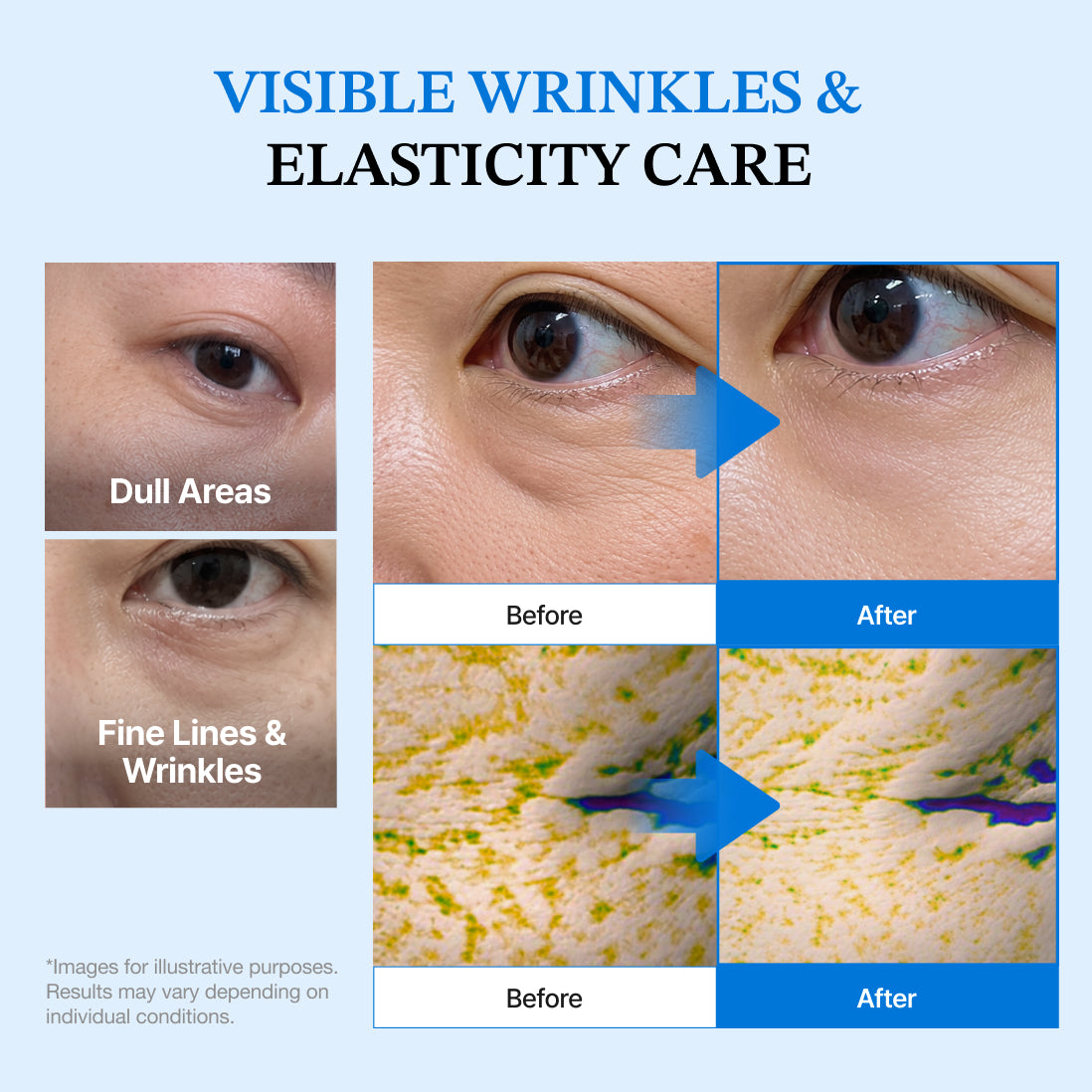 Dermizen Ag EGF Eye Cream