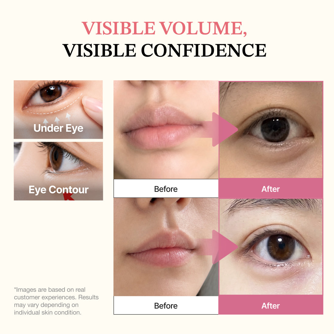 Candaly Plumpop Under Eye Serum