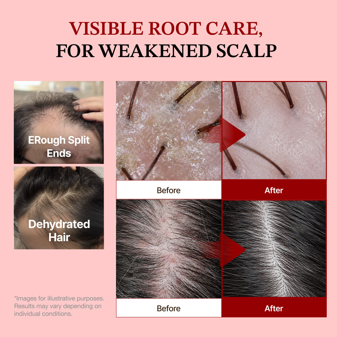 Rowebee Rootvital Peptide Scalp Ampoule