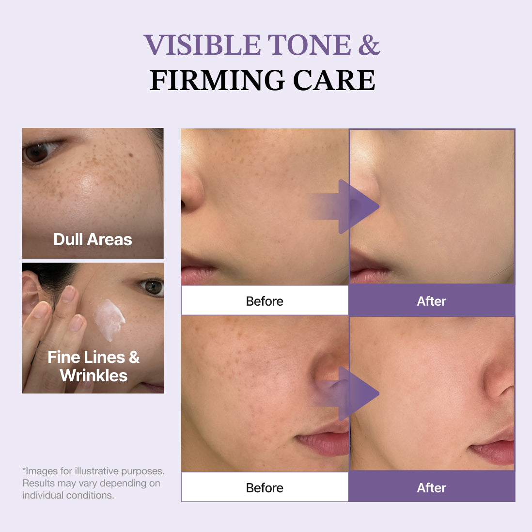 Dermizen AG Peptide Cream