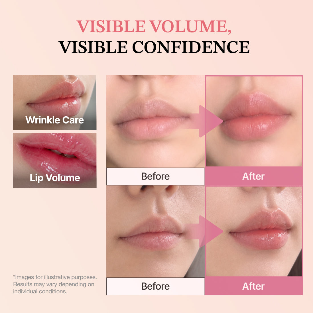 Candaly Plumpop Lip Care Serum