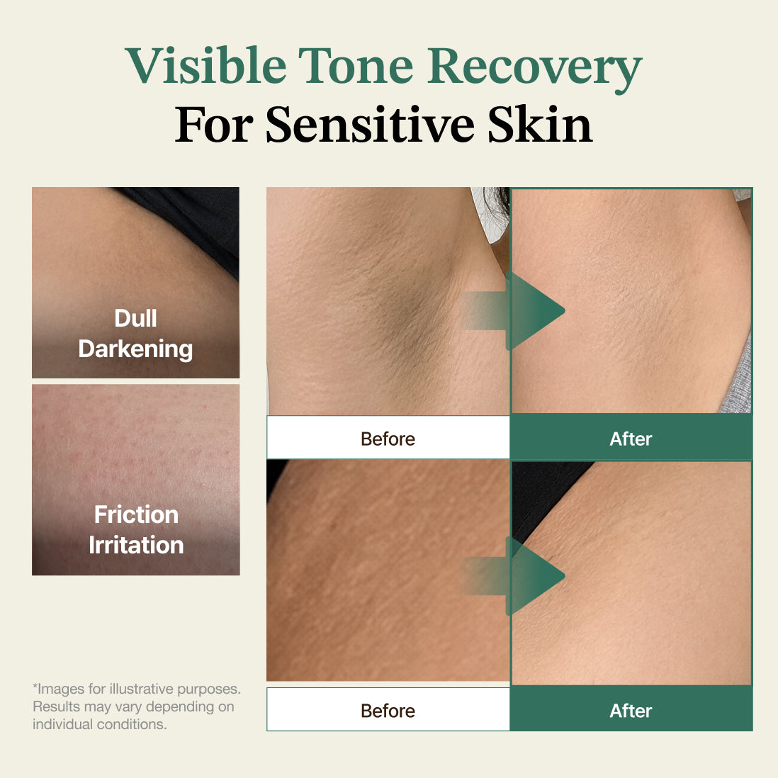 Hersens Pure Balance Tone Care Cream