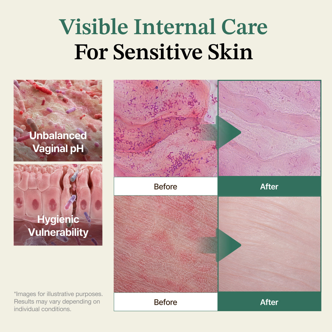 HESENSE Pure Balance In-Care Gel MD