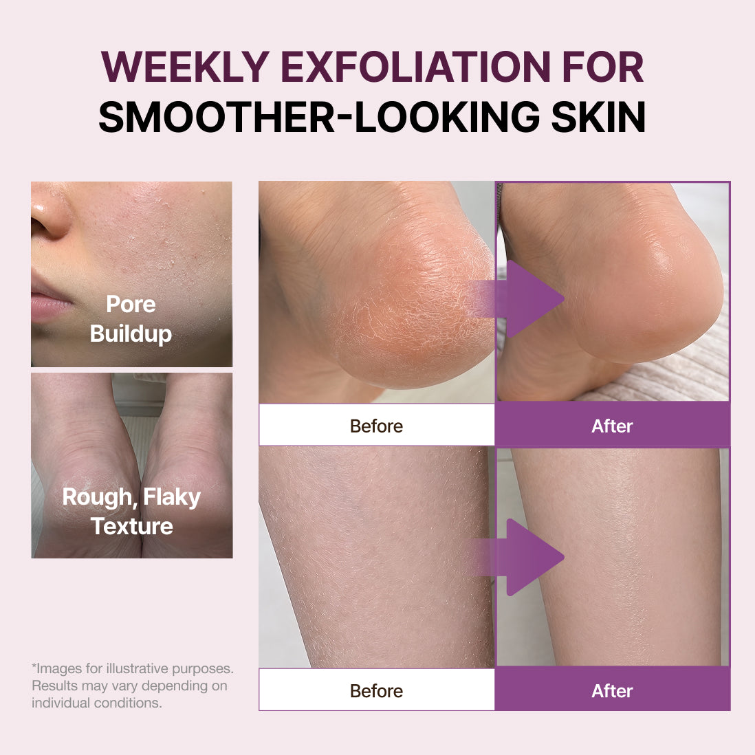 Medimelt Ficus Carica L. Gelato Body Scrub