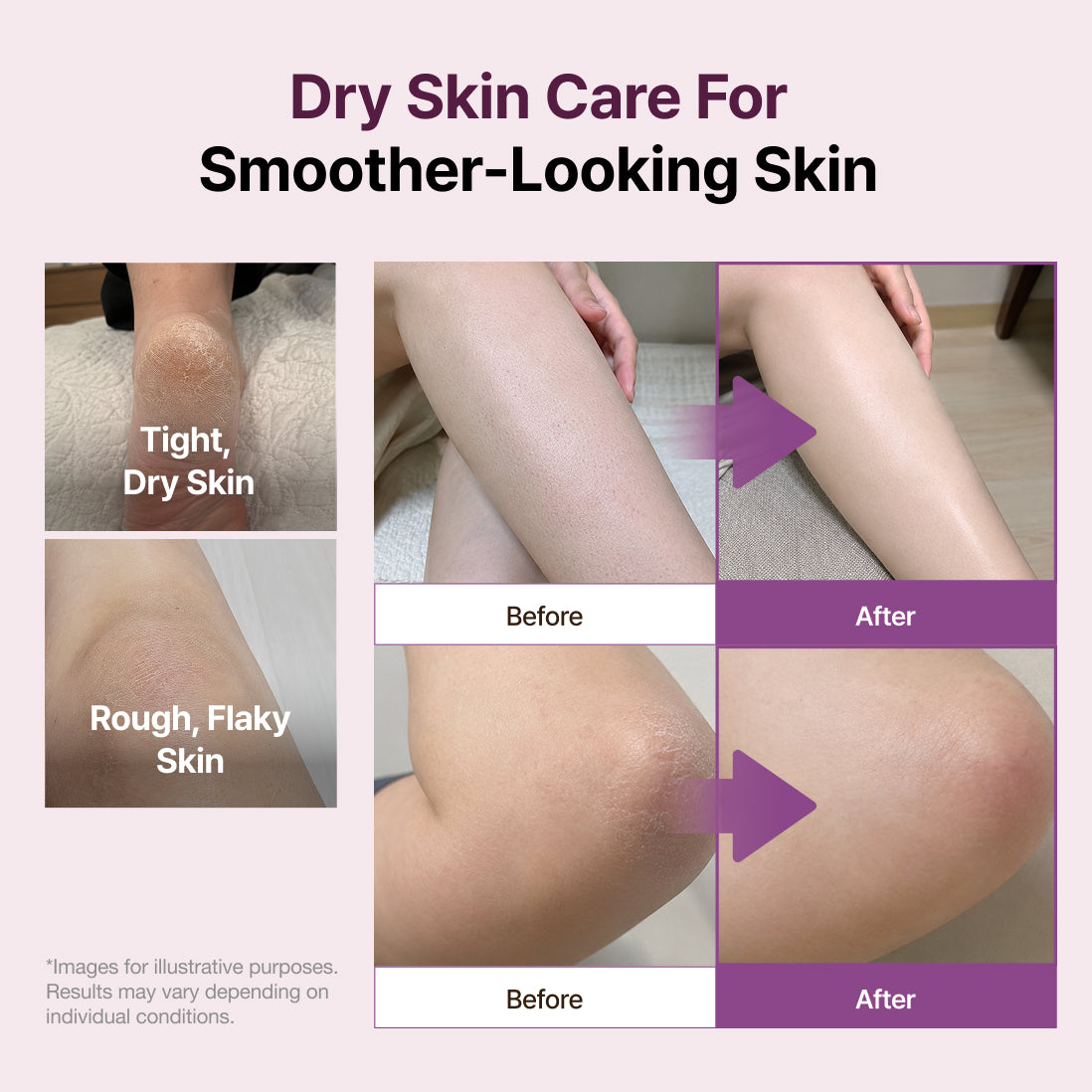 MediMelt Ficus Carica L. Gelato Body Balm