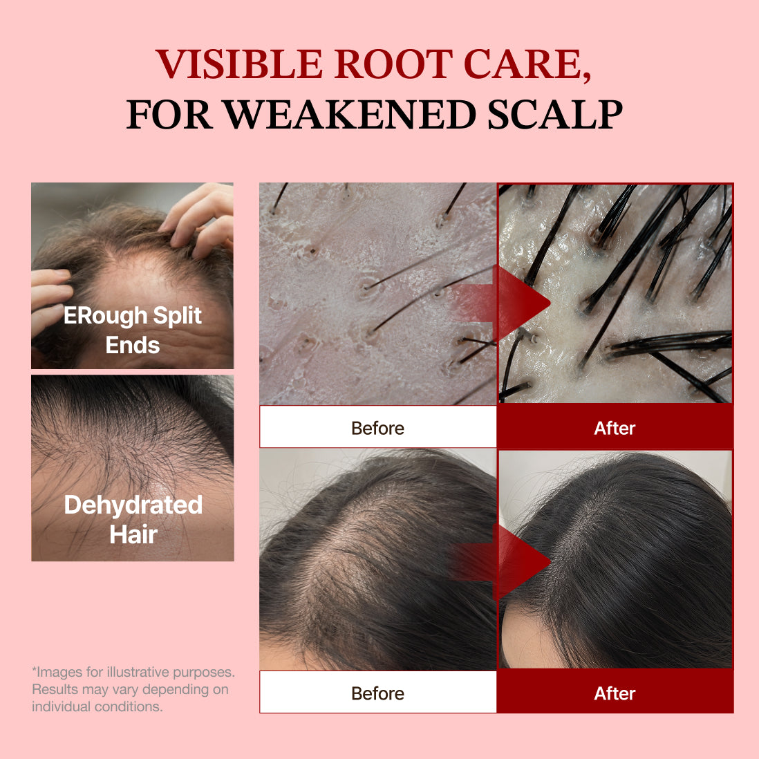 Rowebee Rootvital Peptide Scalp Enhancer