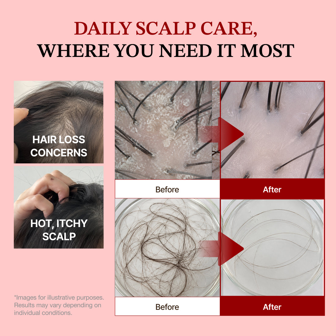 Rowbee Root Vital Scalp Booster X